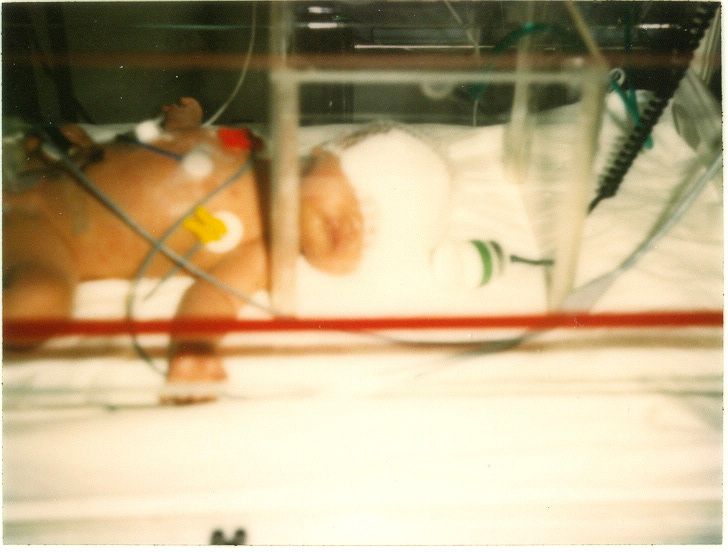 Jennifer as a tiny baby in an incubator, photo from the 1980's